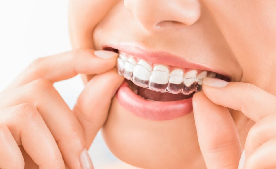 Invisalign® Treatment in Denver, CO