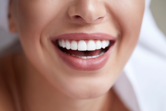 Reiser Dental performed full-mouth reconstruction on a woman in Denver, CO